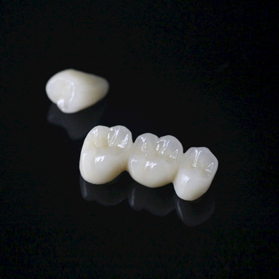 合成树脂牙（复色）